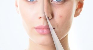 Best dermatologist in mississauga canada